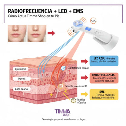 Masajeador Facial Timma Shop - Radiofrecuencia LED EMS 3 en 1 Antiarrugas Profesional