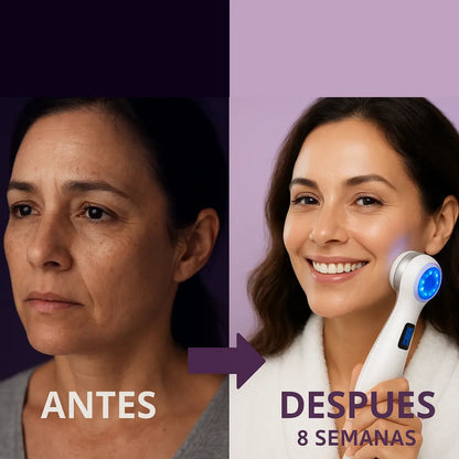 Masajeador Facial Timma Shop - Radiofrecuencia LED EMS 3 en 1 Antiarrugas Profesional