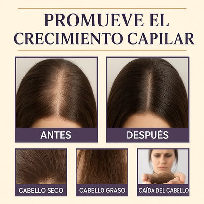 Aceite de Batana 100% Puro 100ml - Crecimiento Capilar Natural | Cabello Dañado | Timma Shop