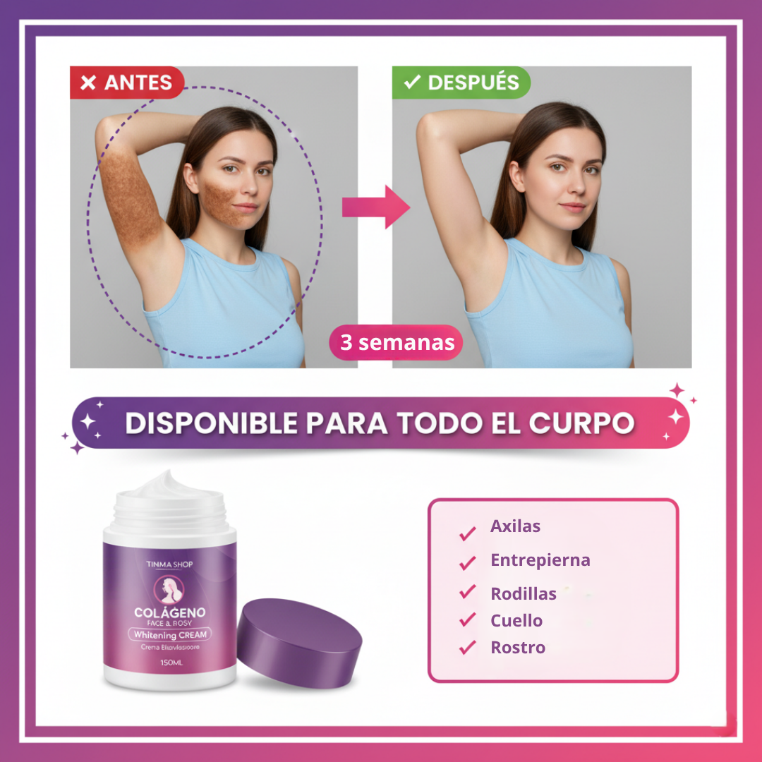 Crema Blanqueadora Axilas Codos Entrepierna 150ml | Timma Shop