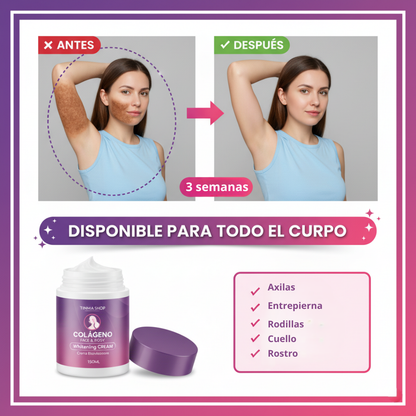 Crema Blanqueadora Axilas Codos Entrepierna 150ml | Timma Shop